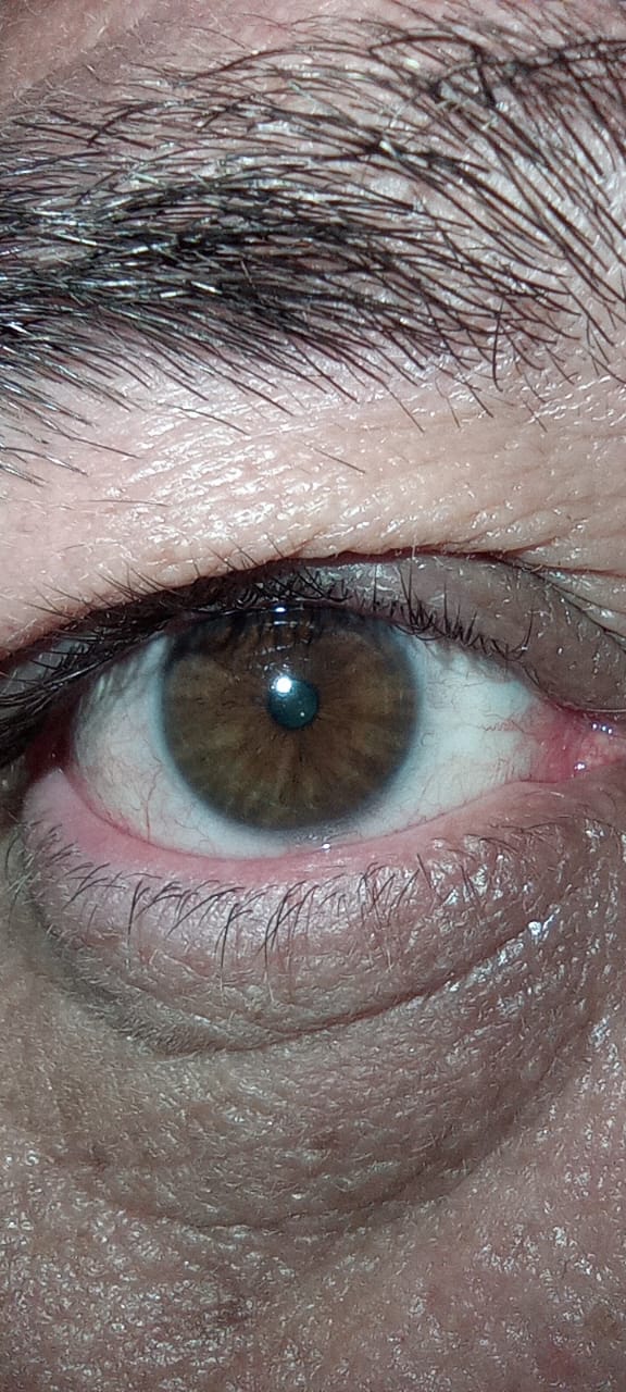 <div class="pupi_ur_most-voted-reaction-badge" data-reaction-count="1"><img src="https://routters.vip/qa-plugin/pupi-ur/public/img/like.png" class="pupi_ur_reaction-image-question-list" data-reaction-id="1"></div>¿De que oclor son tus osjo?